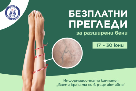 Безплатни прегледи за разширени вени ще се проведат в 20 града на България
